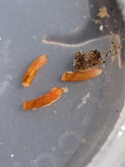 Caecum dextroversum