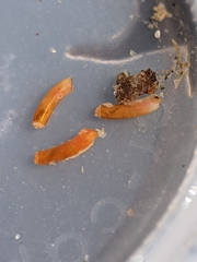 Caecum dextroversum