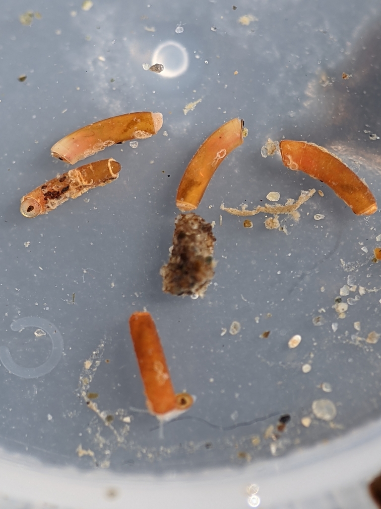 Caecum dextroversum