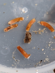 Caecum dextroversum