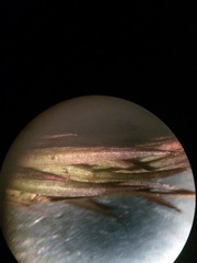 Polytrichastrum ohioense