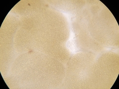 Phaeocystis