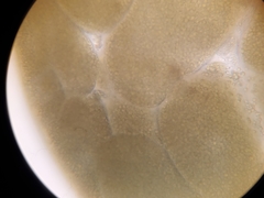 Phaeocystis