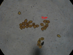 Puccinia juncophila