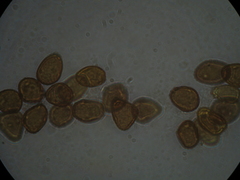 Puccinia juncophila