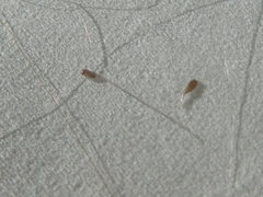 Pediculus humanus capitis