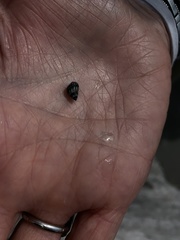 Echinolittorina placida