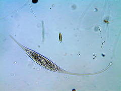 Amphileptus procerus