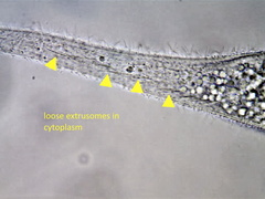 Amphileptus procerus