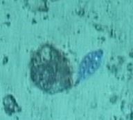 Microstomus bathybius