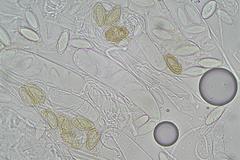 Ascobolus hawaiiensis