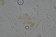 Ascobolus hawaiiensis