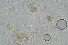 Ascobolus hawaiiensis