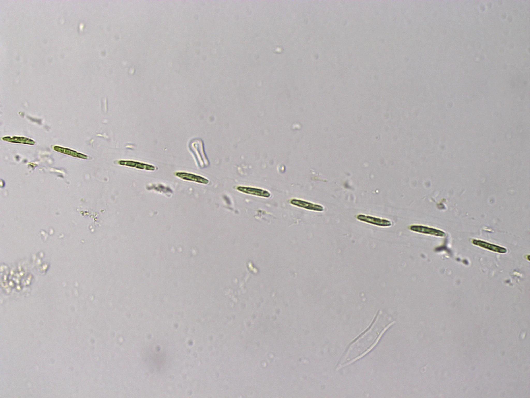 Elakatothrix