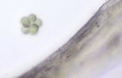 Sphaerocystis
