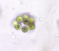Coelastrum