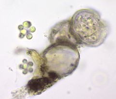 Sphaerocystis