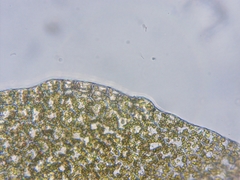 Lophoziopsis excisa