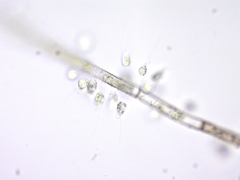Bicoecida
