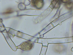 Botryobasidium conspersum