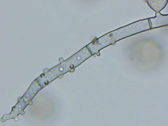 Botryobasidium conspersum