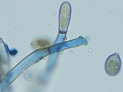 Botryobasidium conspersum