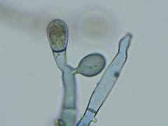 Botryobasidium conspersum