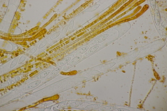 Byssonectria fusispora