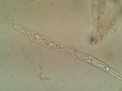 Sclerotinia trifoliorum