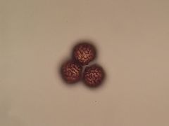 Fossombronia incurva