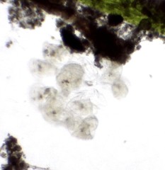 Conochilus hippocrepis