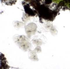 Conochilus hippocrepis