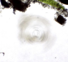 Conochilus hippocrepis