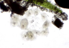 Conochilus hippocrepis