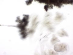 Conochilus hippocrepis