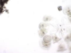 Conochilus hippocrepis