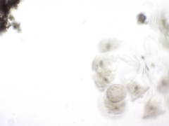 Conochilus hippocrepis