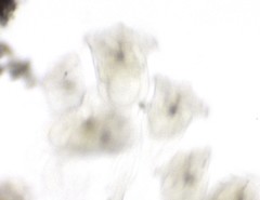 Conochilus hippocrepis