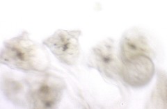 Conochilus hippocrepis