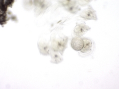 Conochilus hippocrepis