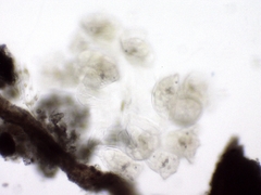 Conochilus hippocrepis