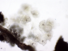 Conochilus hippocrepis