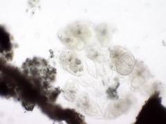 Conochilus hippocrepis