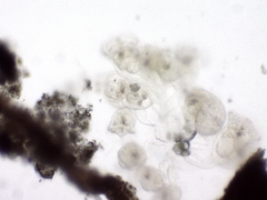 Conochilus hippocrepis