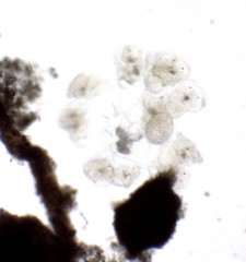 Conochilus hippocrepis