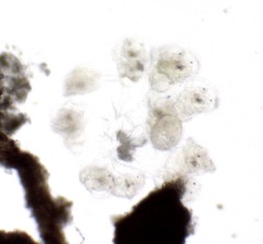 Conochilus hippocrepis