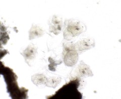 Conochilus hippocrepis