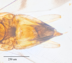 Leptomastidea abnormis
