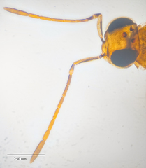 Leptomastidea abnormis