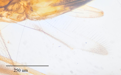Leptomastidea abnormis